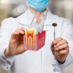 Root Canal Treatment: What to Expect and How It Can Save Your Tooth